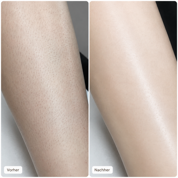 Velmora™ 2-in-1 SmoothSkin Rasierer