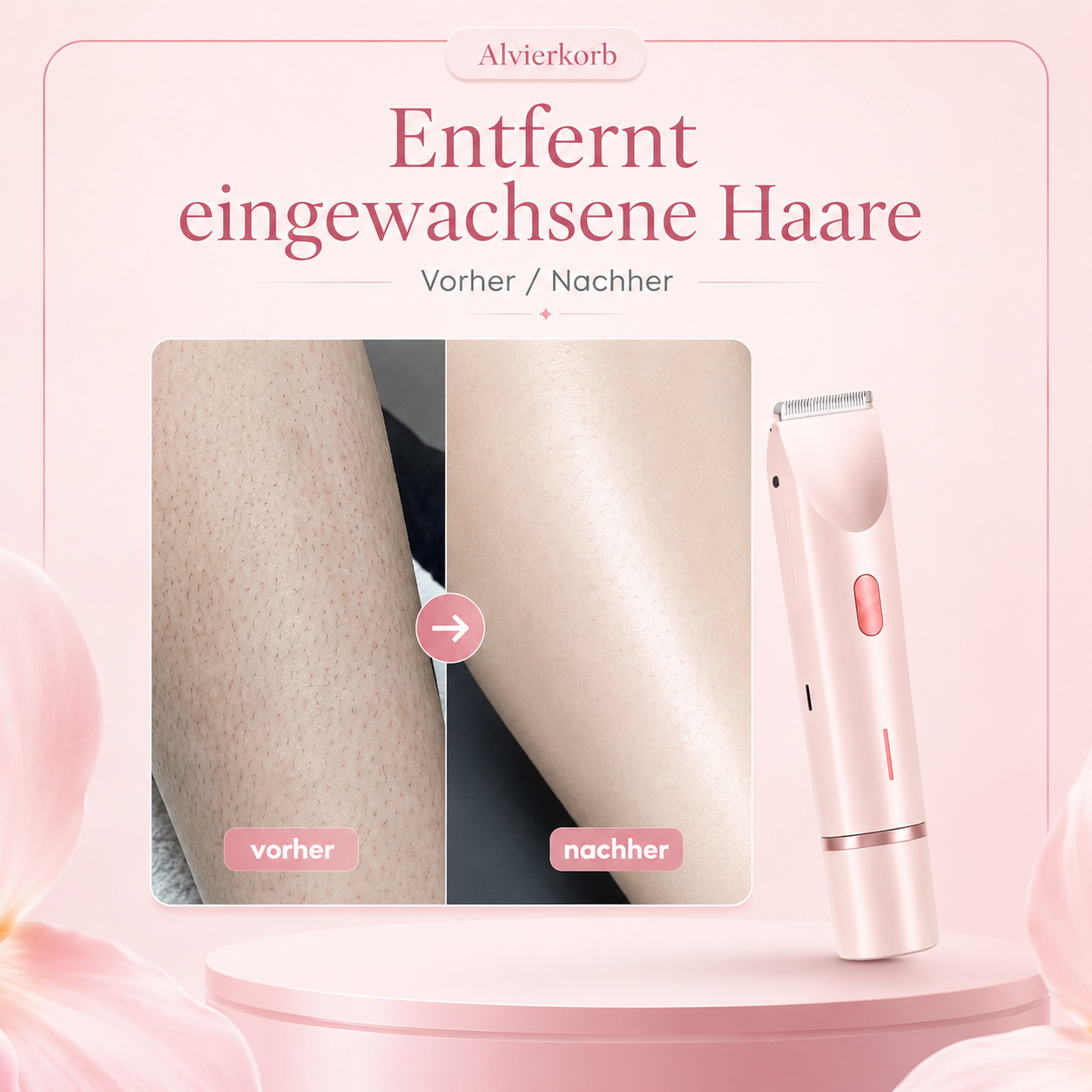 Velmora™ 2-in-1 SmoothSkin Rasierer