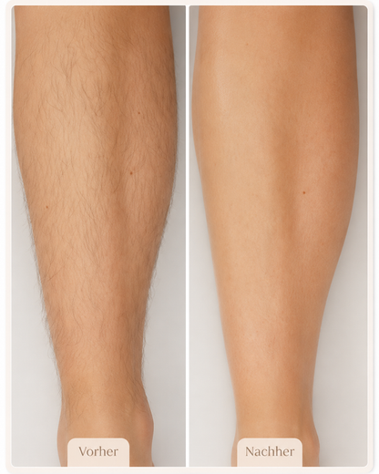 Velmora™ 2-in-1 SmoothSkin Rasierer