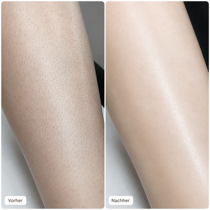 Velmora™ 2-in-1 SmoothSkin Rasierer